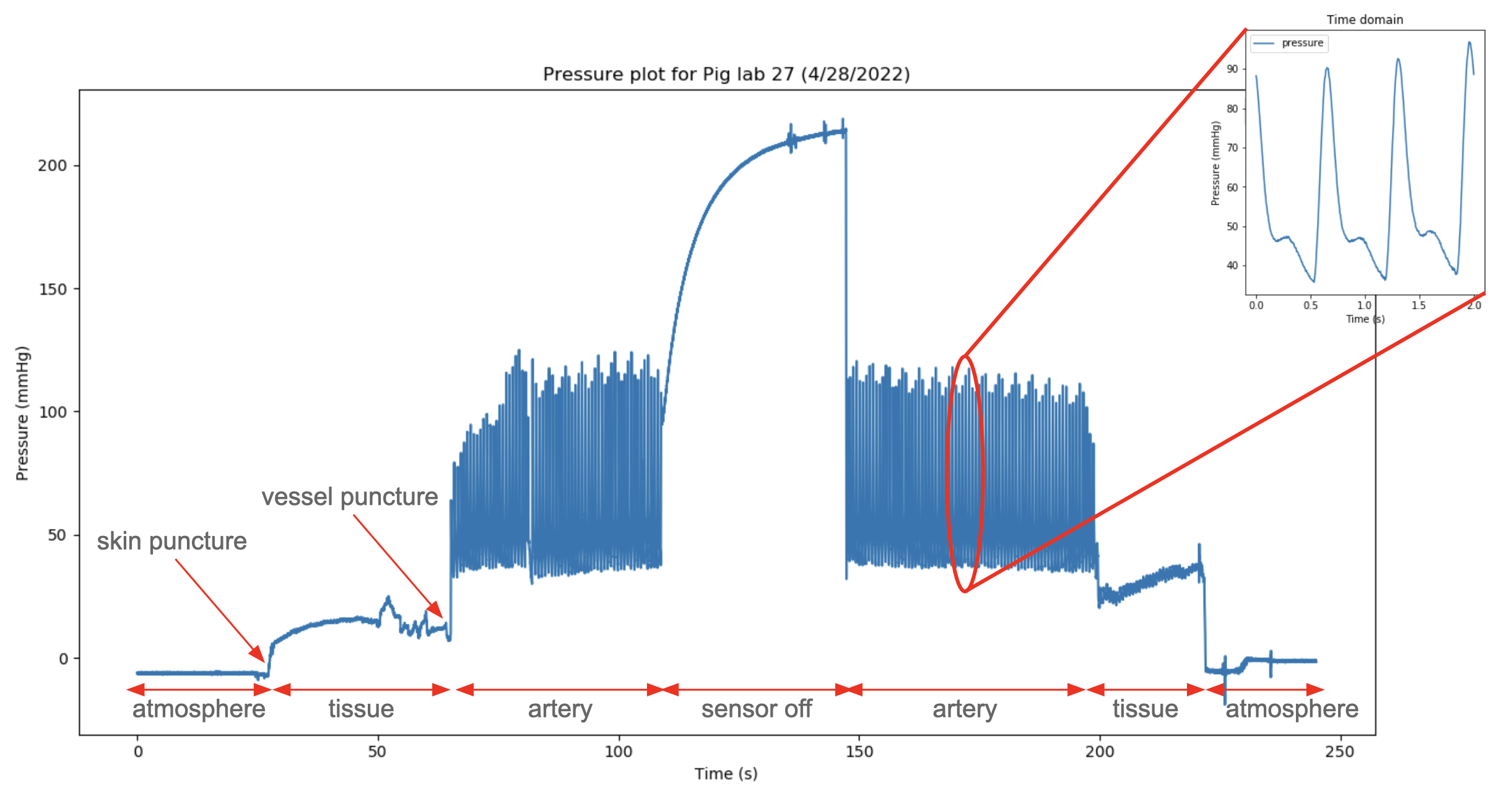 Arterial Insertion Pressure plot